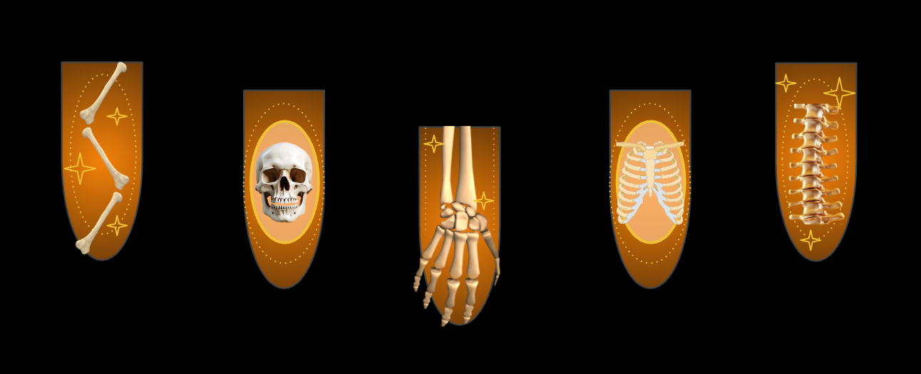 Cast image