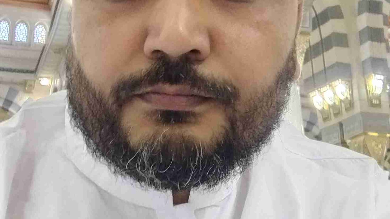 Malik125 (malik125.lens) Lens social identity (.lens handle) PFP