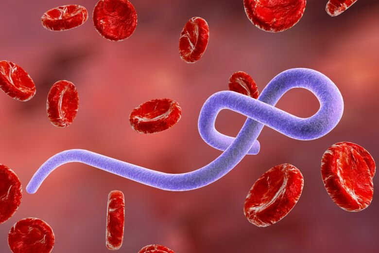 EBOLA