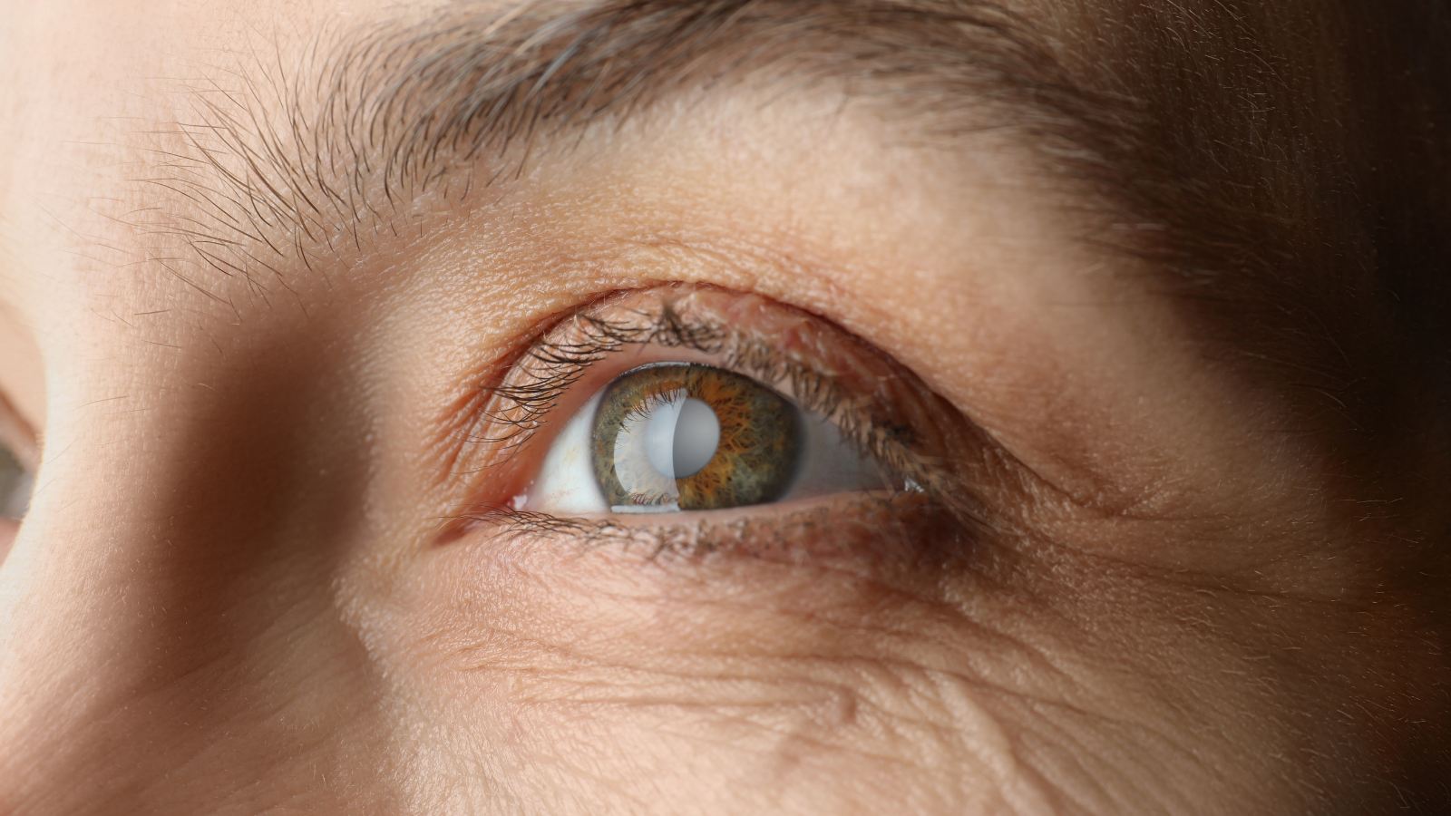 Cataract Treatment
