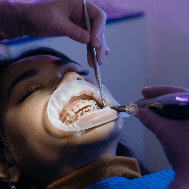 Dental Treatments