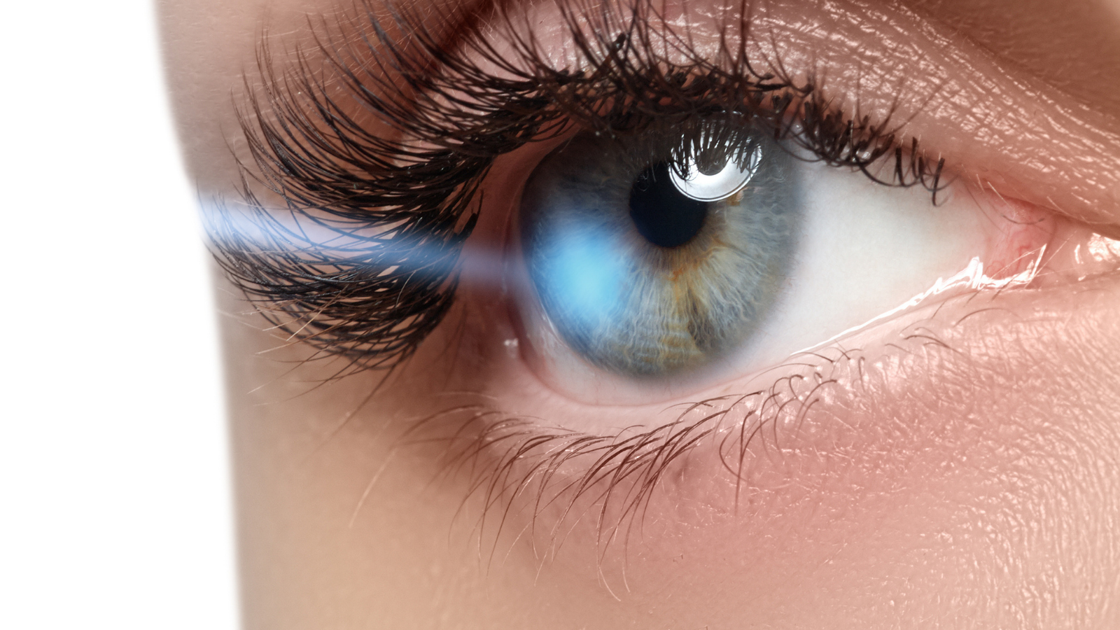 LASIK Eye Surgery