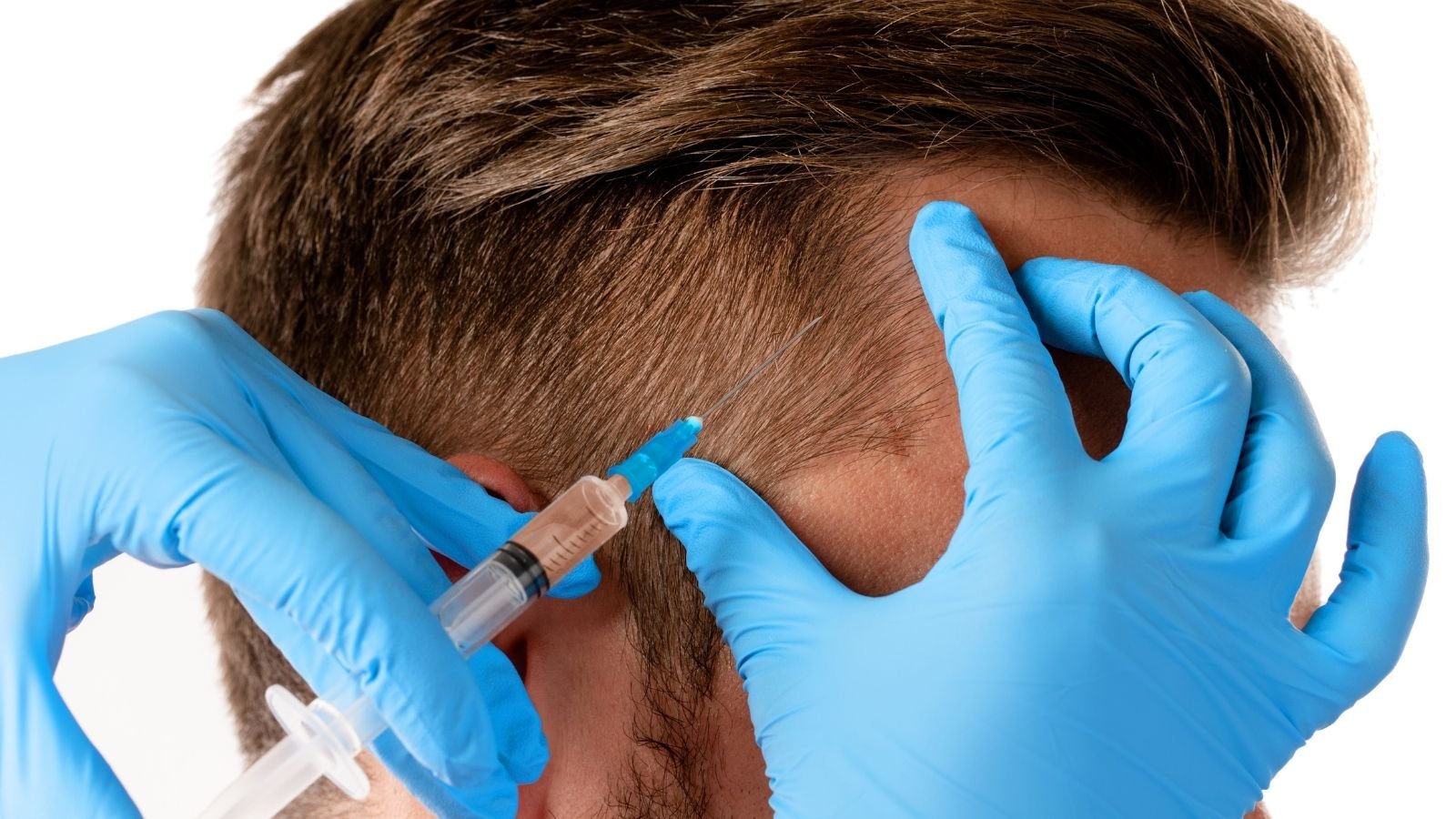 Revitalize Your Hair with PRP Treatment at Tana Clinic