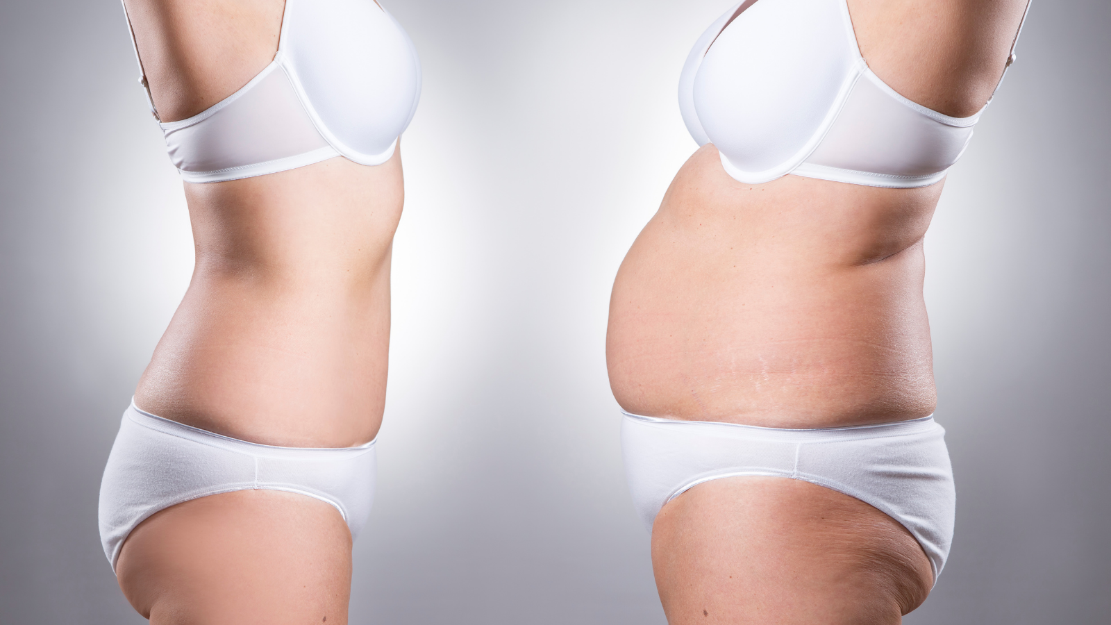 Vaser Liposuction and BBL