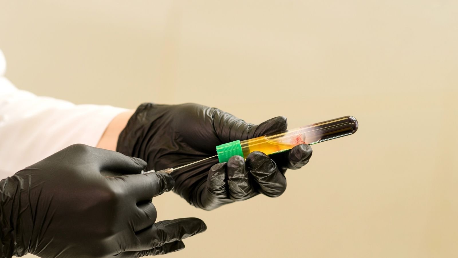 PRP for Skin Rejuvenation