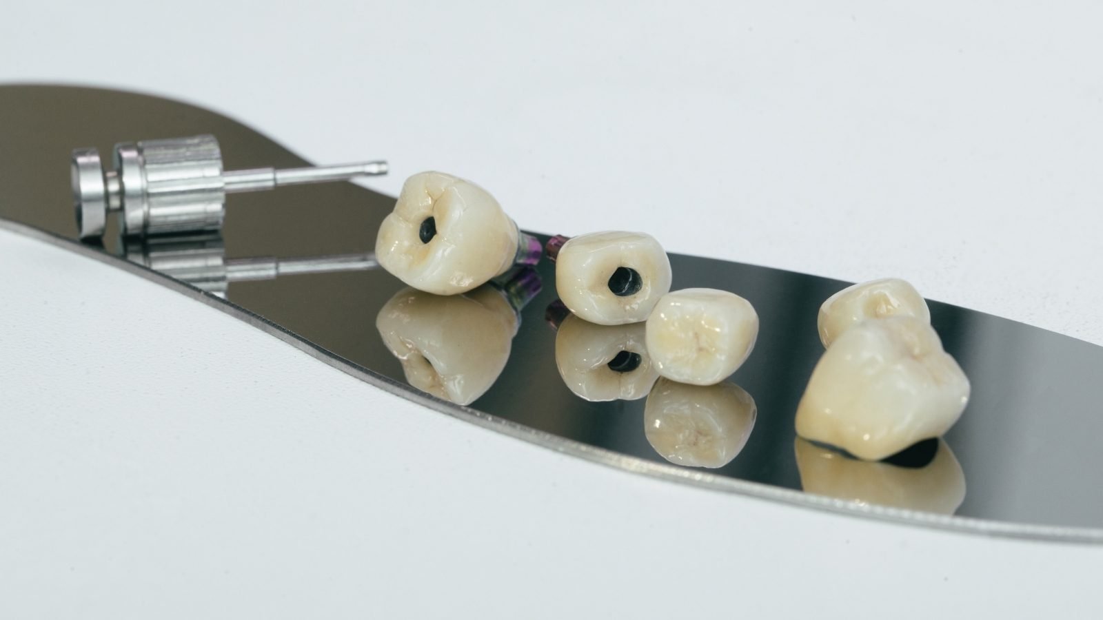 Screw-Retained Zirconium Crown on Implant