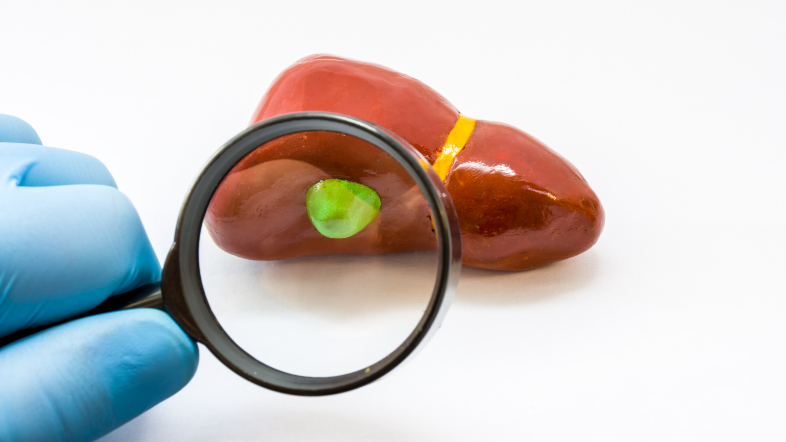 Gallbladder Surgery