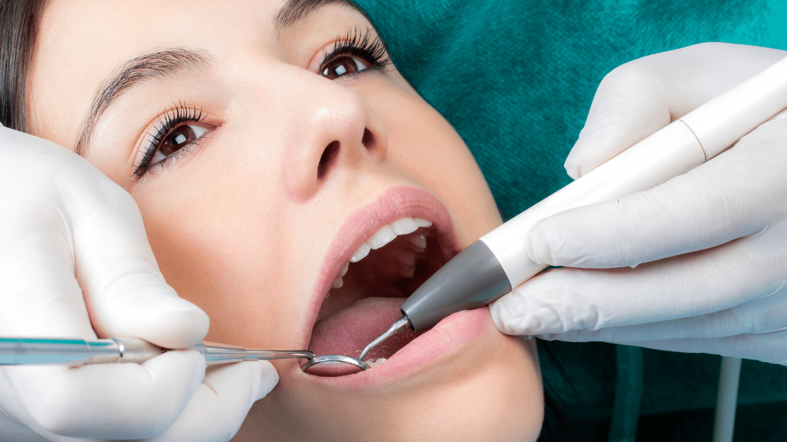 Dental Cleaning