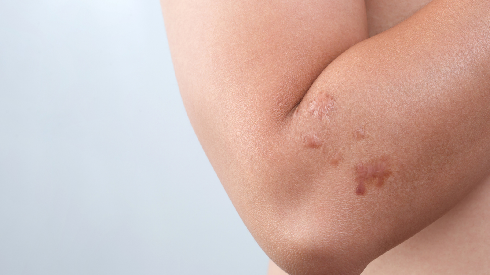 Skin and Soft Tissue Surgery