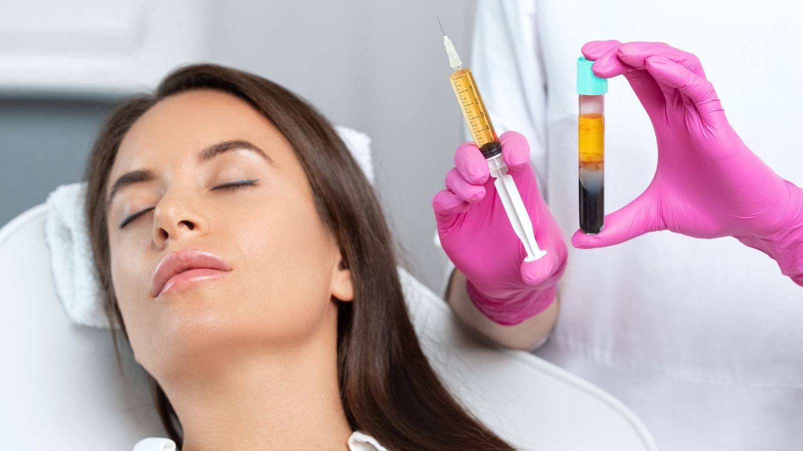 PRP for Hair