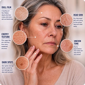 Diagram of a woman's face showing dull film, crepey texture, dark spots, dead skin, and uneven tone