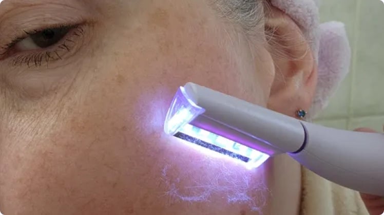 Close-up of the SonicSmooth device with a soft sonic glow against the skin