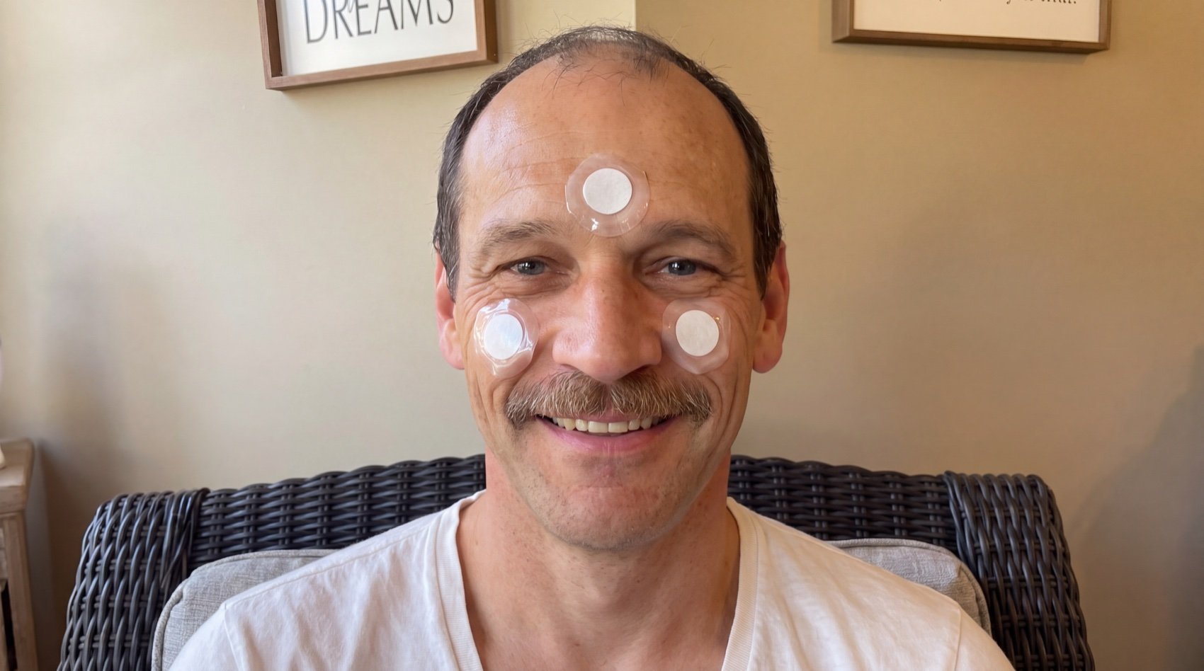 A man with sinus relief patches on his face