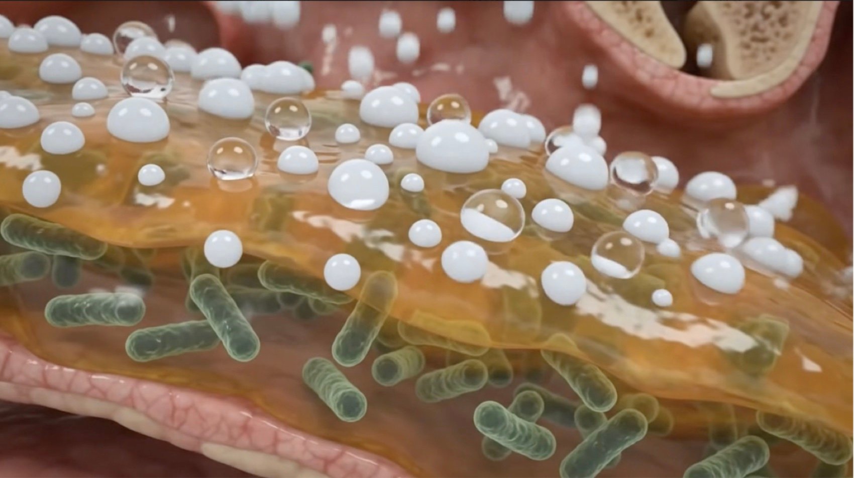 Nasal spray droplets sitting on top of a bacterial biofilm