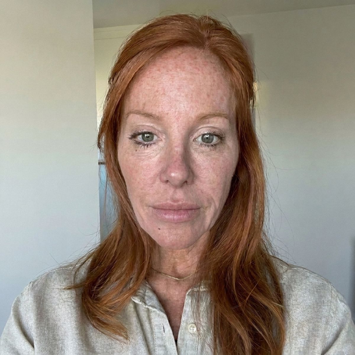 Skin before using SonicSmooth Pro+