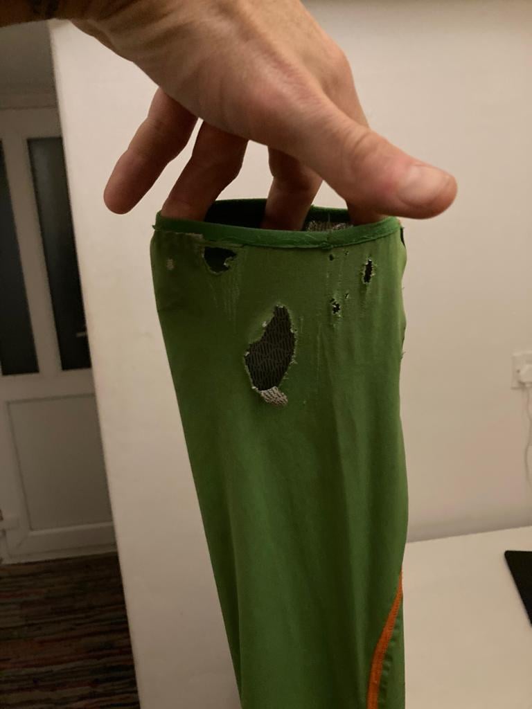 Sleeve of a Jacket with A Hole In It