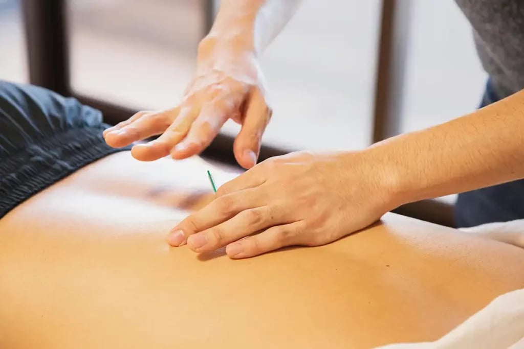 close of acupuncture