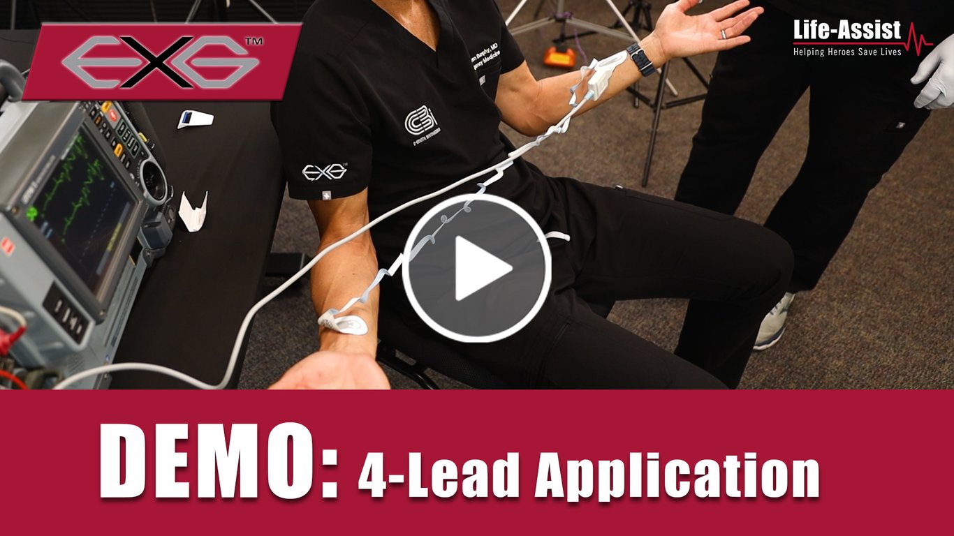 Monitor rate and rhythm using 4-Lead EXG Electrodes.