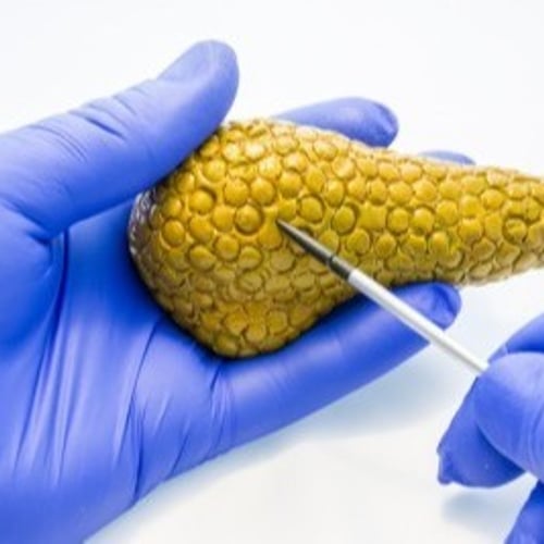 Inherited BRCA Mutation ...