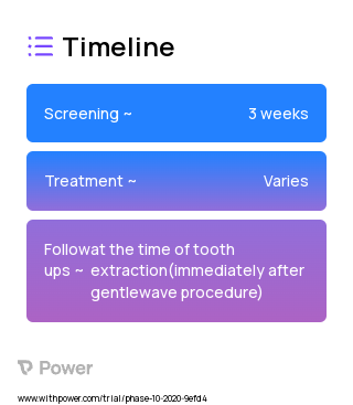 GentleWave (Endodontic Treatment) 2023 Treatment Timeline for Medical Study. Trial Name: NCT04105907 — N/A