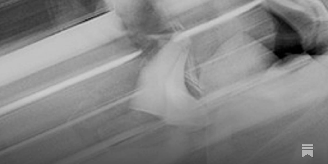 running fast nowhere