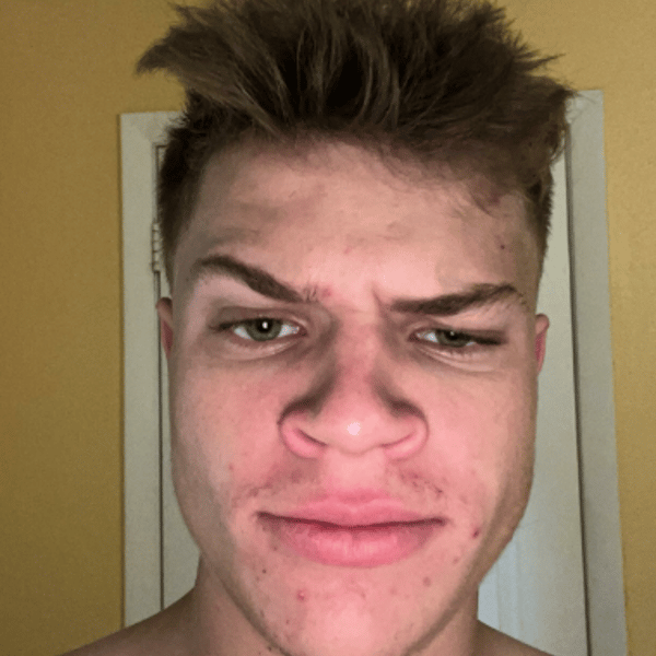 Another Thumbnail