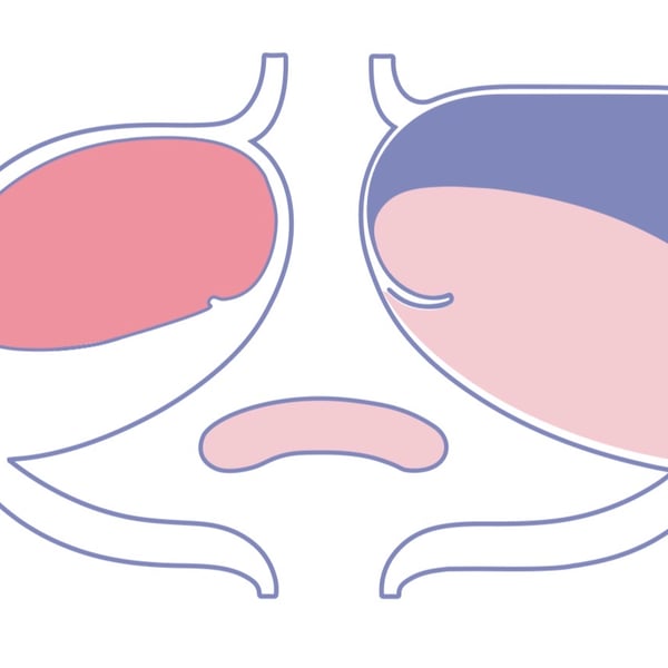 GIF Thumbnail
