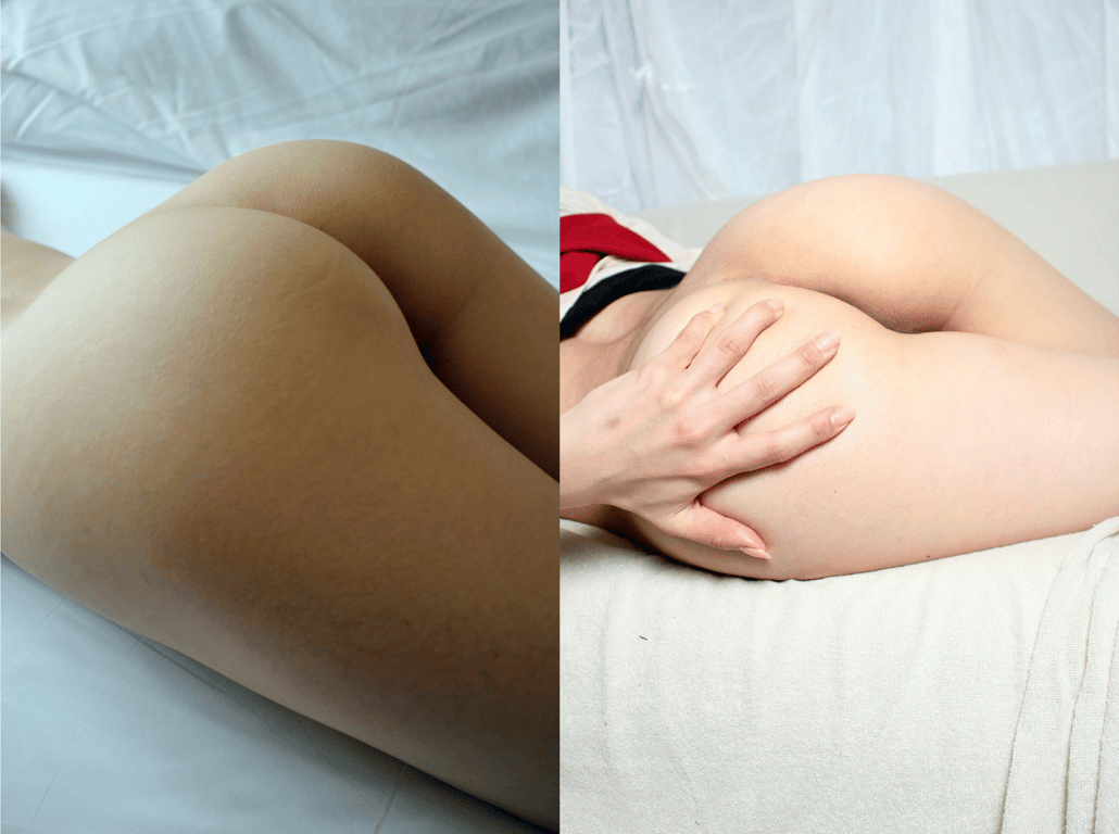 图片[36]-#週刊POST数码写真集 100人的臀部 - 全本免费在线观看-阅图吧