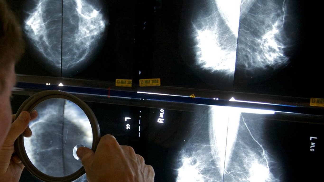 Revolutionary Studies Suggest Less Surgery Needed for Early Breast Cancer Patients