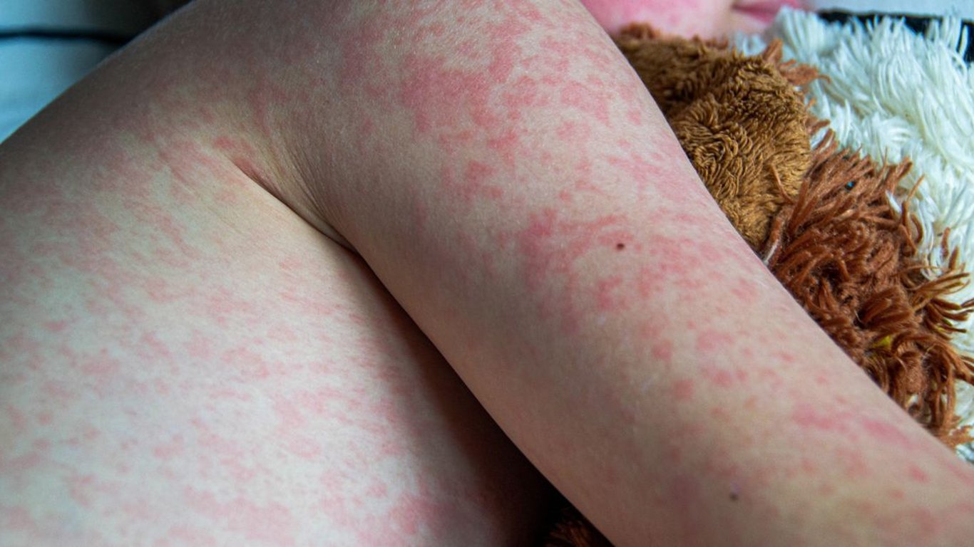 Preparación para Pandemias: Expertos Advierten sobre Enfermedades Emergentes a Medida que se Acerca 2025.