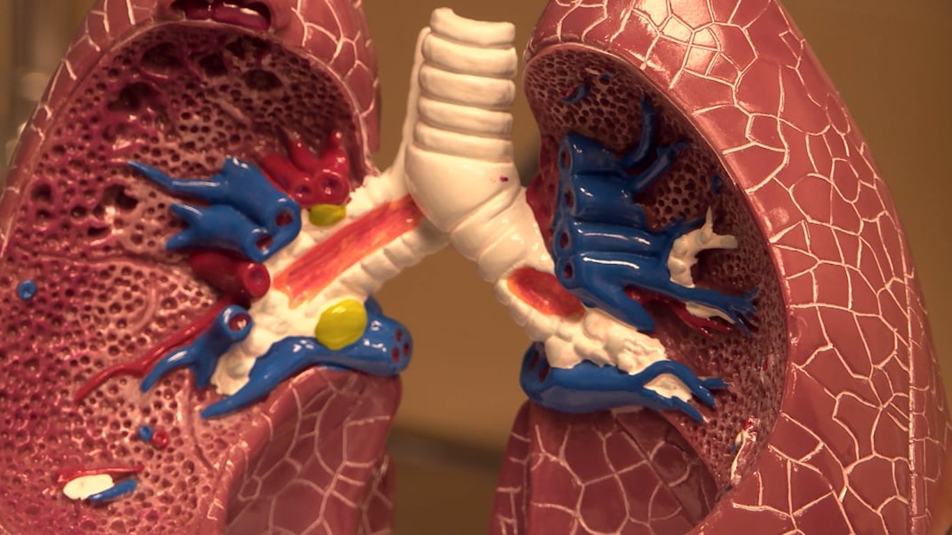 Wisconsin observa una prometedora disminución en las tasas de cáncer de pulmón gracias a los esfuerzos de salud pública.