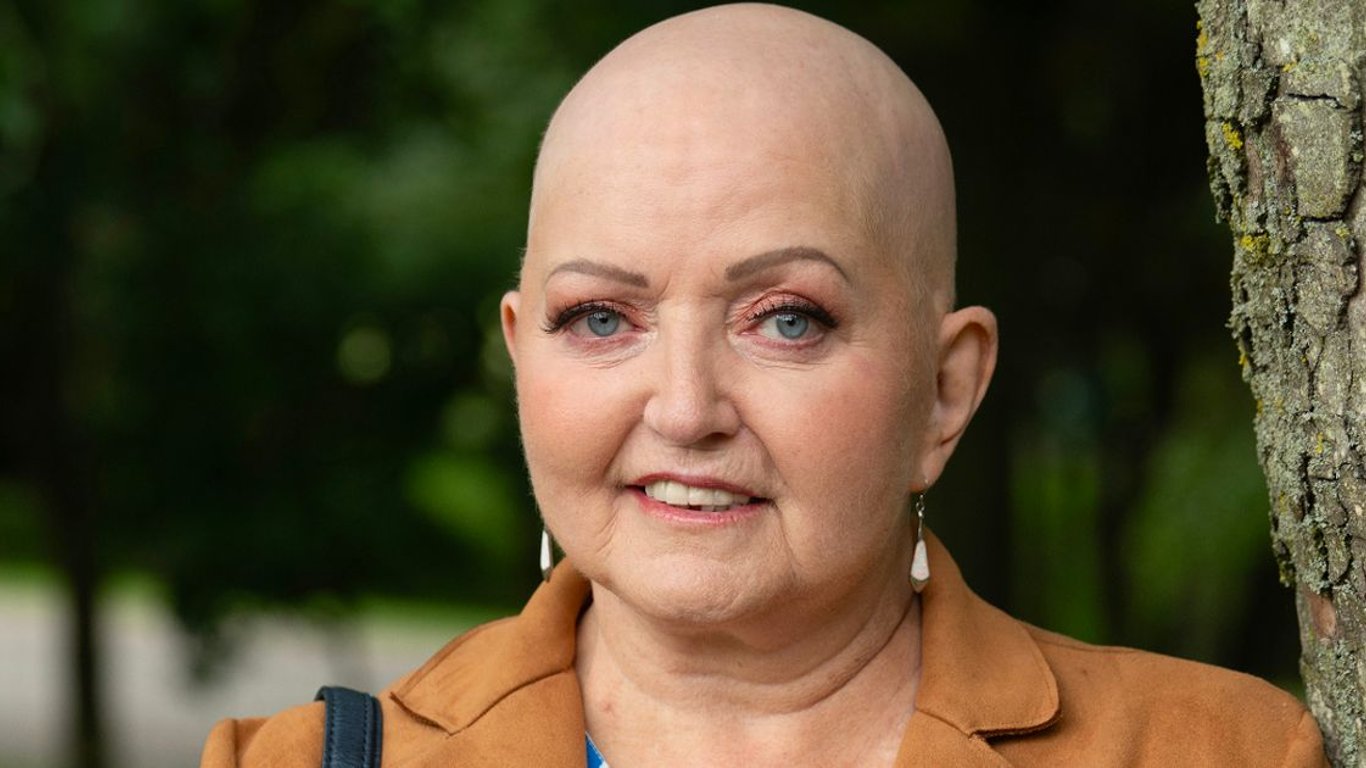 La querida estrella irlandesa Linda Nolan fallece a los 65 años tras una valiente lucha contra el cáncer.