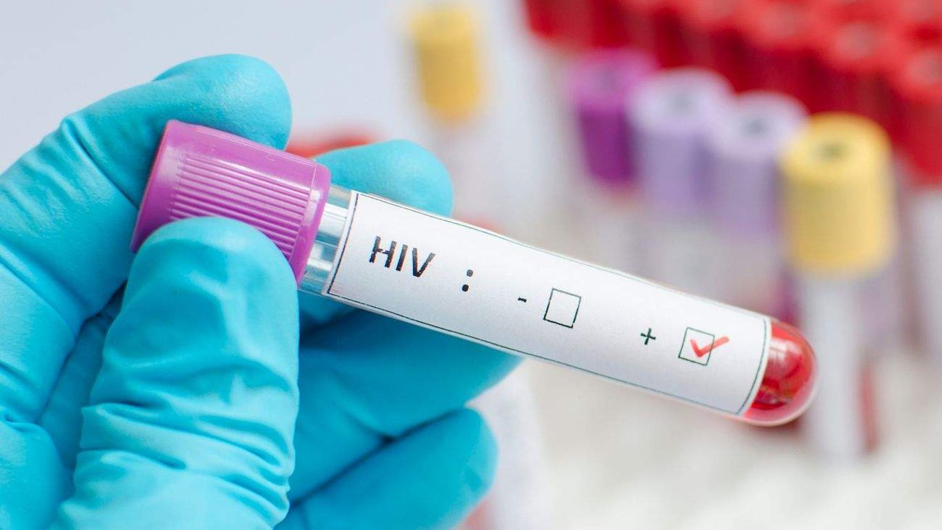 Puebla enfrenta un alarmante aumento del 83% en casos de VIH en un año