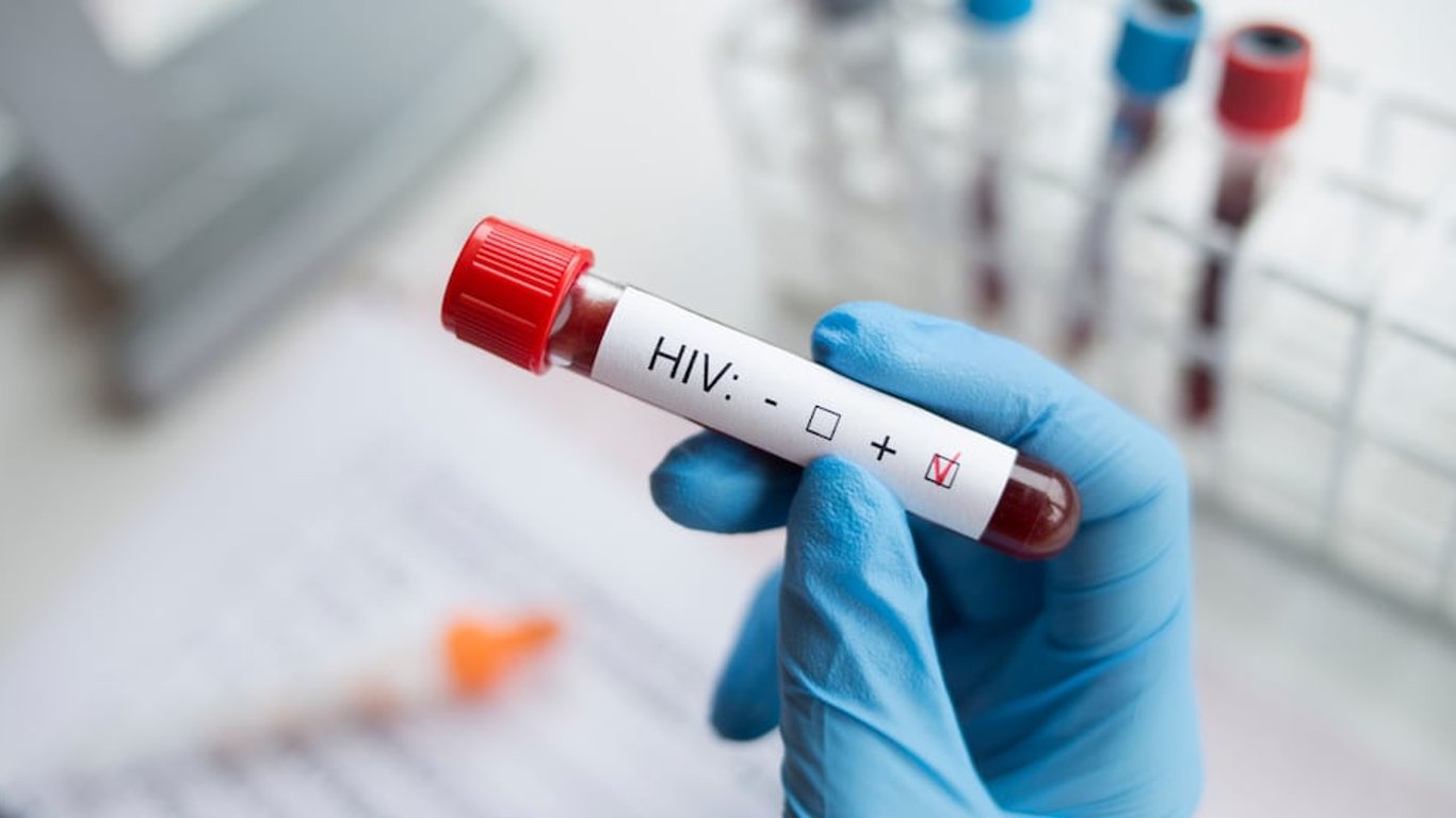 Desmienten rumores sobre epidemia de VIH en América Latina y destacan prevención