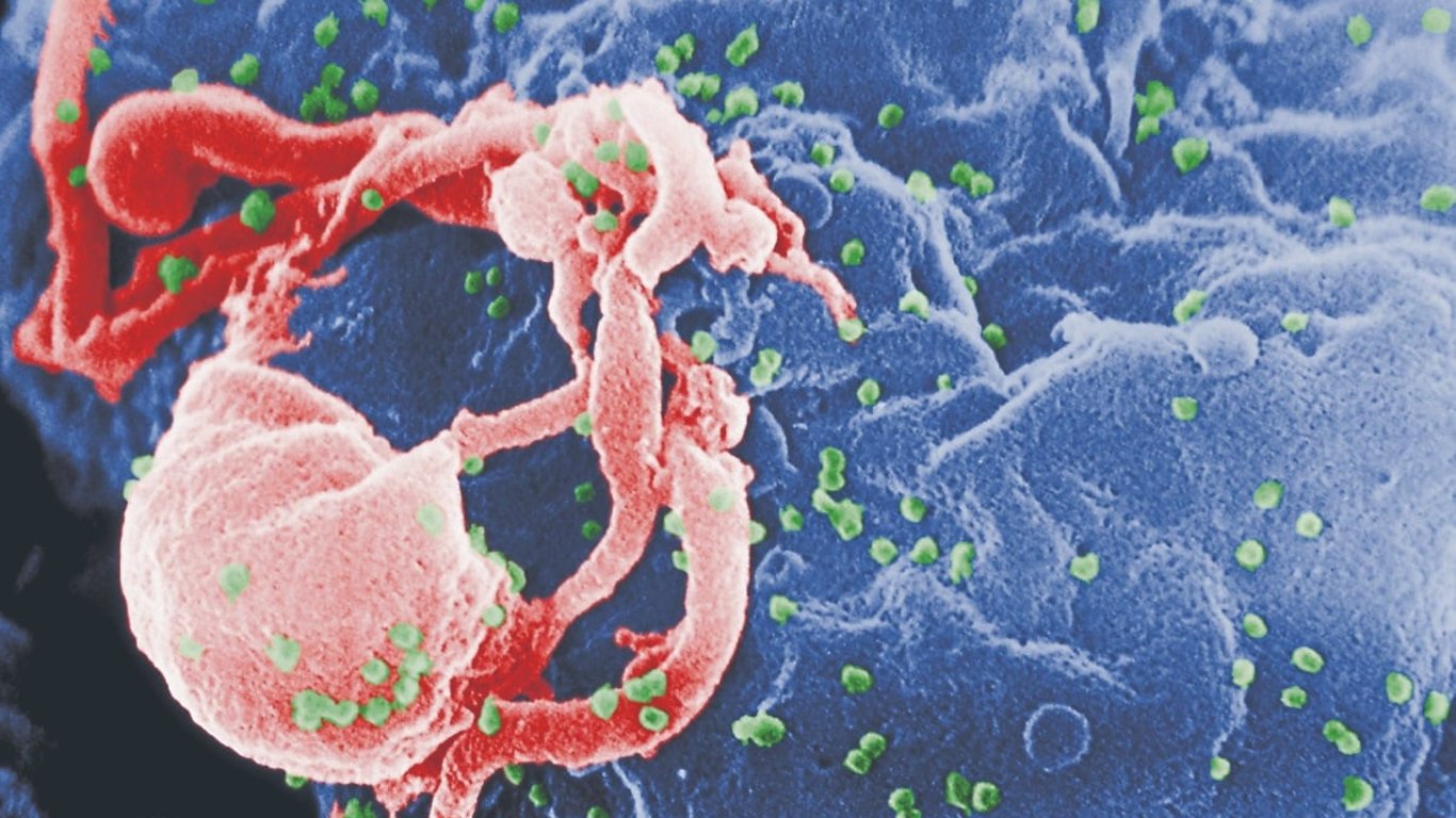 Cuarenta años del VIH: avances en tratamientos y la lucha por la concientización