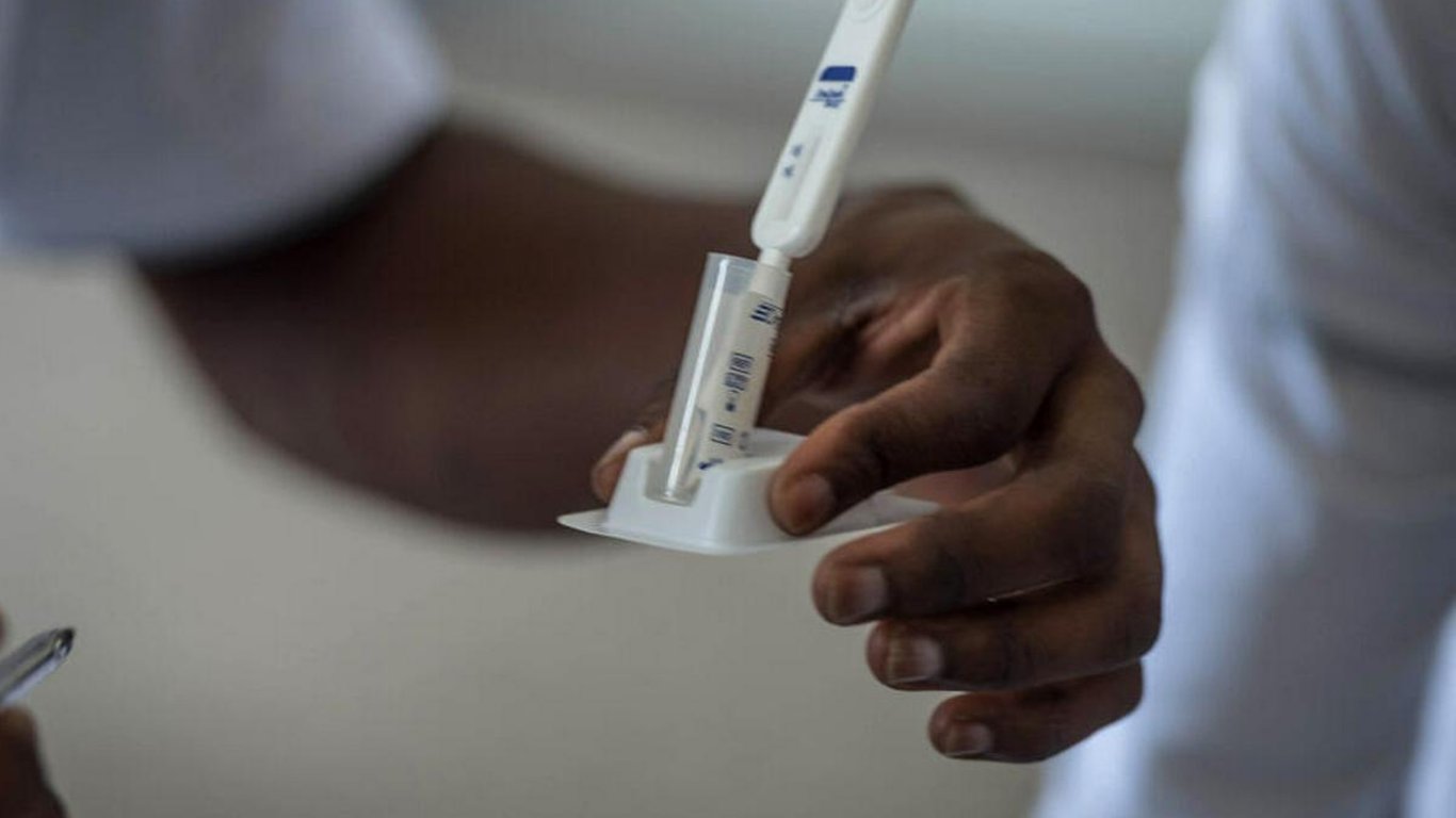 Mujer en Francia alcanza remisión del VIH tras alotransplante de médula ósea