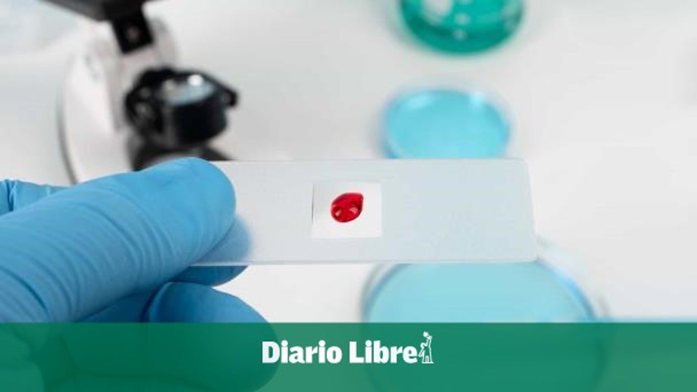 Ministerio de Salud de RD descarta emergencia por VIH y refuerza prevención y tratamiento