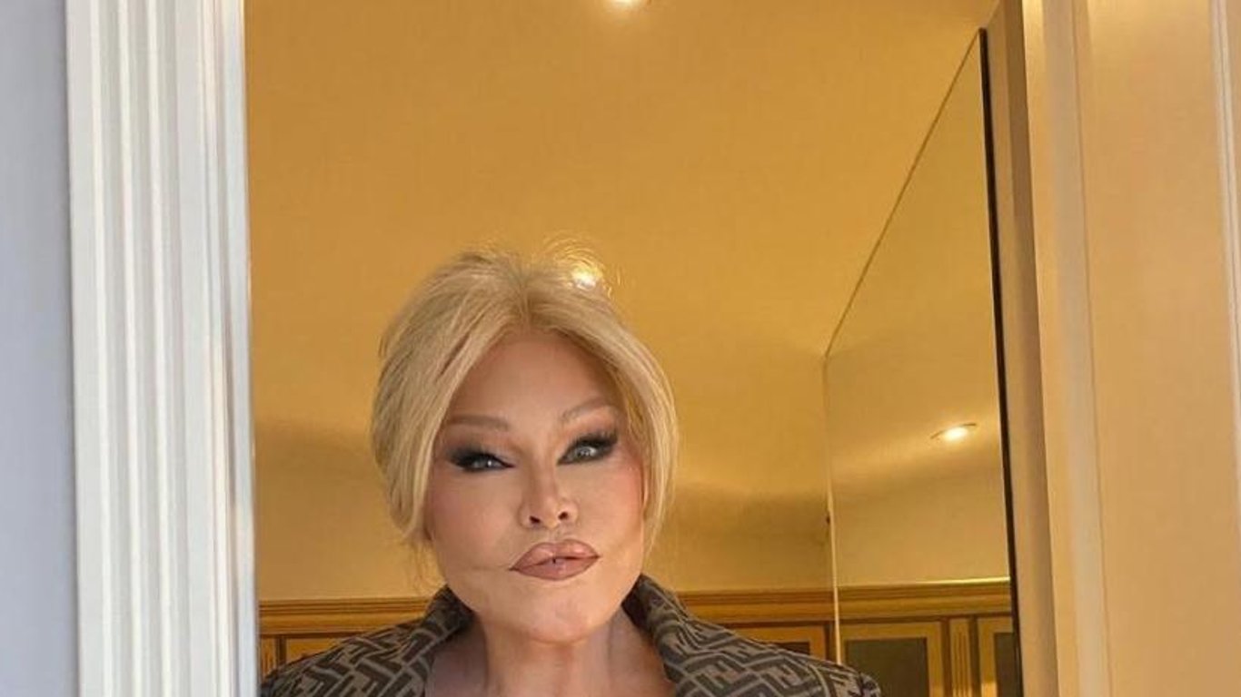 Fallece Jocelyn Wildenstein, ícono del jet set y símbolo de la belleza extrema