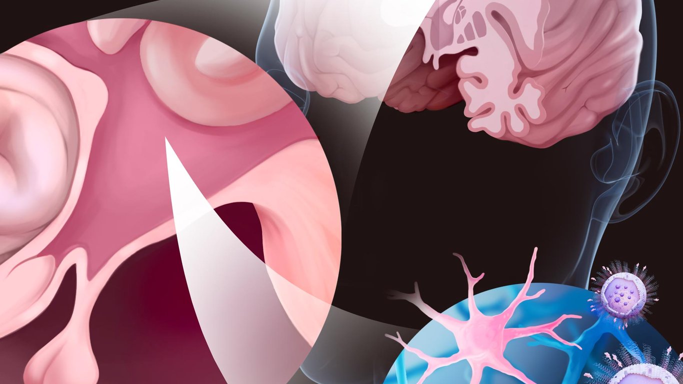 Método revolucionario entrega medicamentos antiinflamatorios a través de la barrera hematoencefálica.