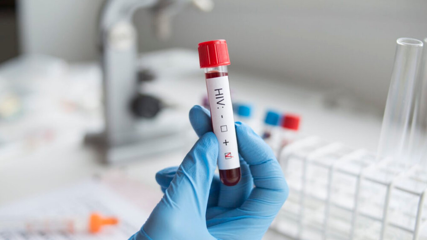 España reduce un 70% los diagnósticos de VIH, pero persiste la desigualdad en prevención