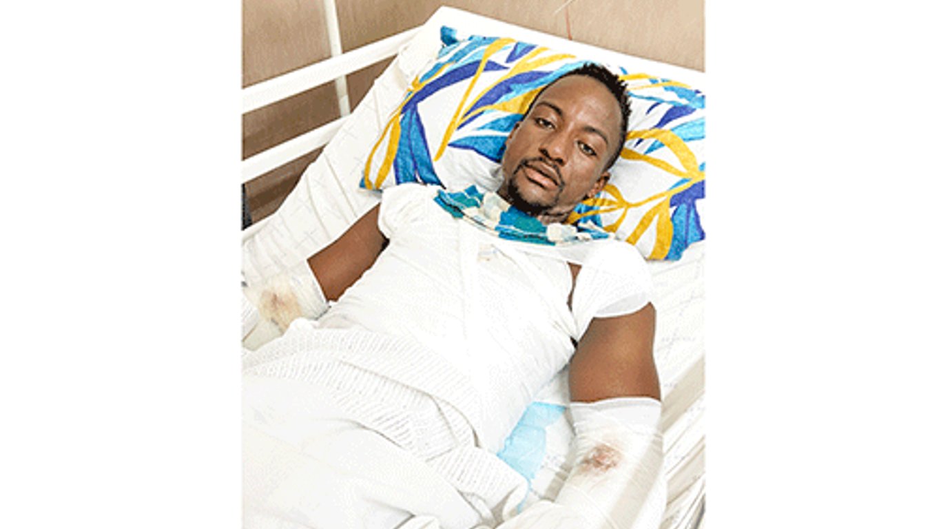 Padre de cuatro lucha por su vida tras un escalofriante choque eléctrico en una obra de construcción.