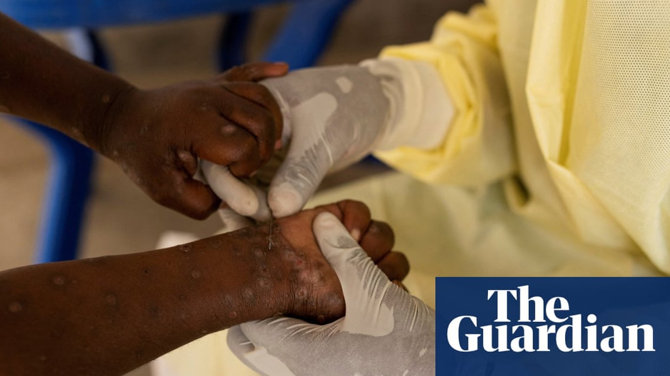 El CDC de África declara una emergencia de salud pública en medio de la creciente crisis de Mpox en la RDC.