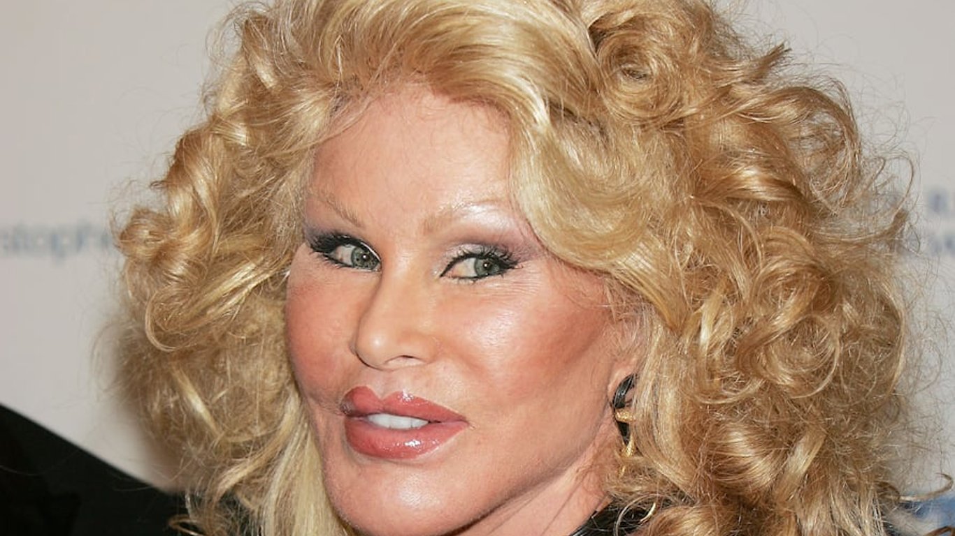 Jocelyn Wildenstein, the iconic Swiss 'Catwoman', passes away at 84 years old.