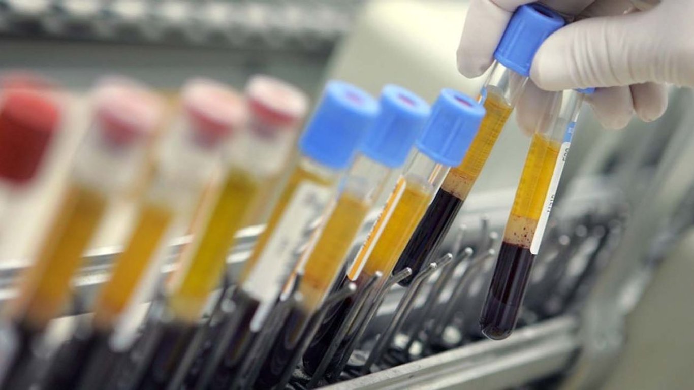 Lenacapavir: Avance prometedor en la lucha contra el VIH y su accesibilidad en duda