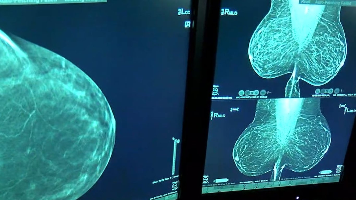 El Centro de Cáncer Stephenson de Oklahoma presenta el innovador sistema Accuray Radixact.