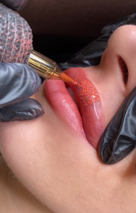 Lip pigmentation procedure in progress