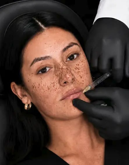 comprehensive dermal filler background portrait