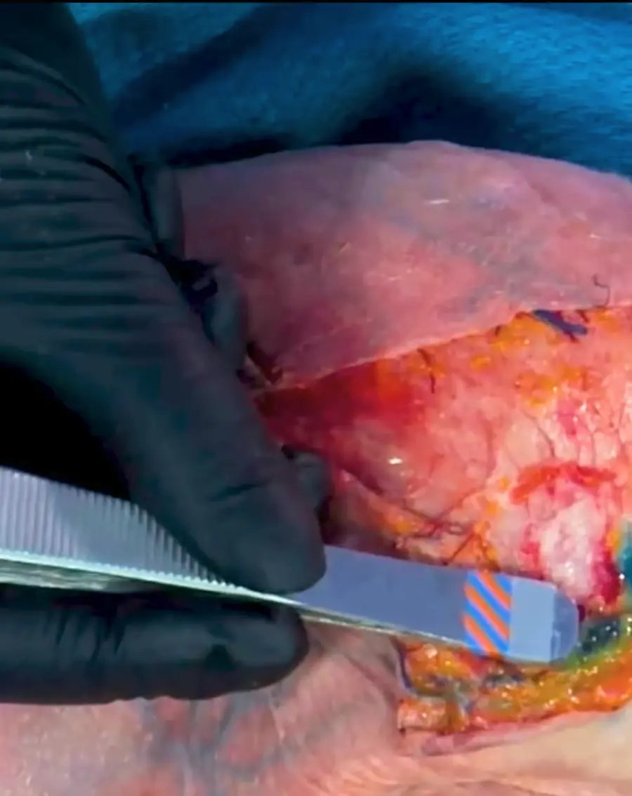 Advanced Facial Anatomy Cadaver Workshop for Aesthetics background portrait