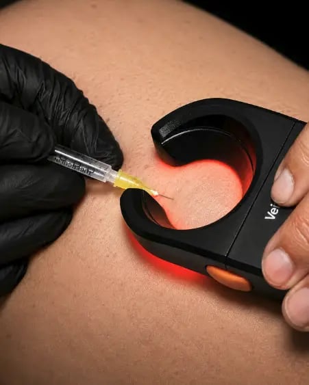 sclerotherapy for physicians and nurses background portrait