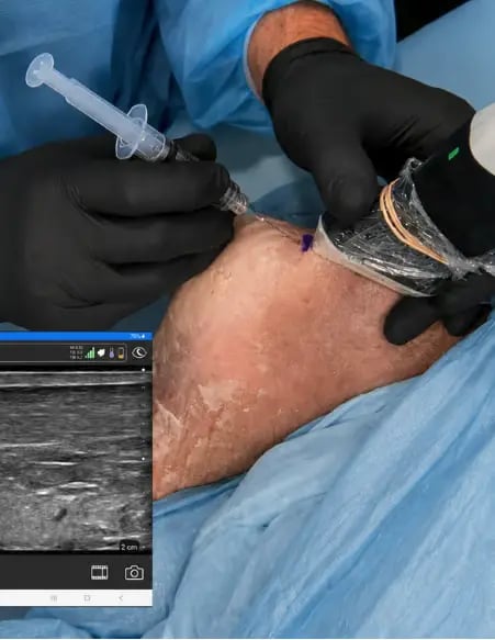 Ultrasound-Guided Interventional Pain Management Procedures